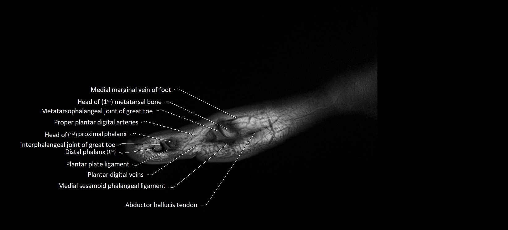 MRI foot sagittal labelled cross sectional anatomy image  2.webp
